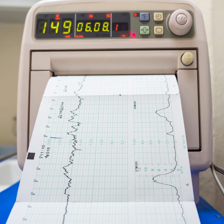 How to Monitor the BCH Stress Test and Get Involved